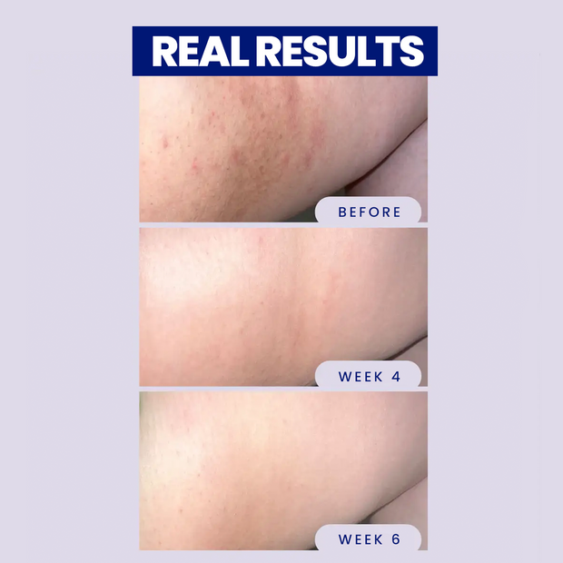 Night Rescue Overnight Brightening Stick