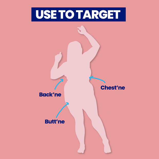 Chest-o Presto Acne Spray