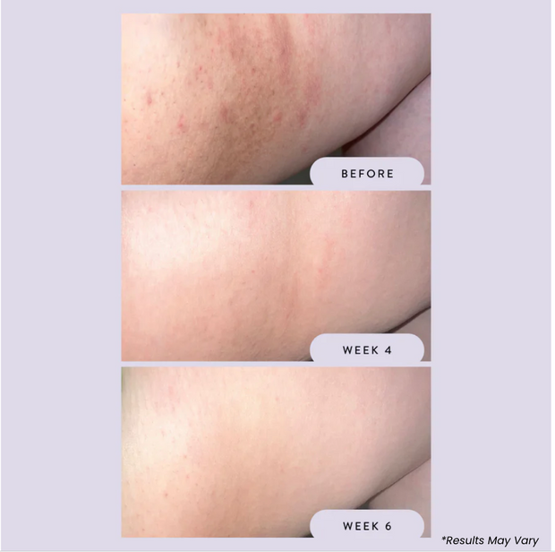 Night Rescue Overnight Brightening Stick